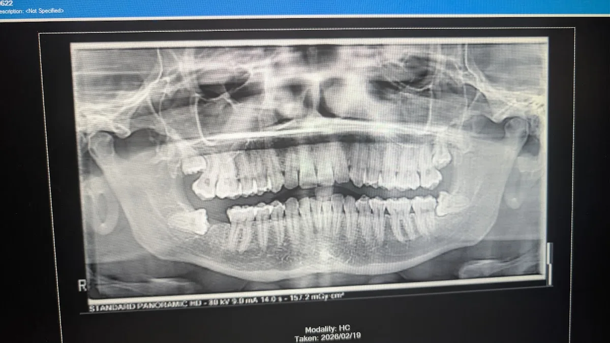 1021 Dental in Albany, NY: Dental Implant Consult Fit—What to Confirm Before You Book