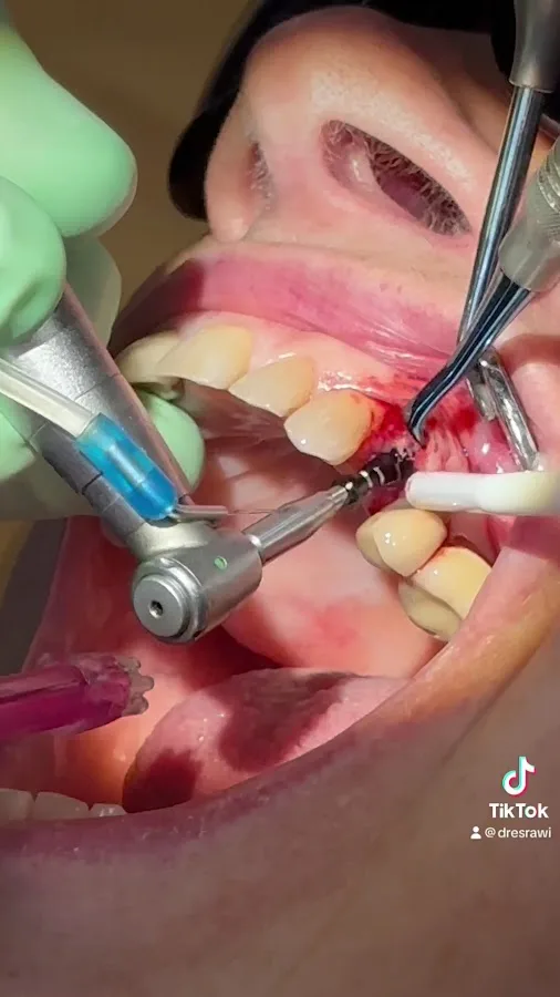 Advanced Cosmetic & Implant Dentistry — photo 4