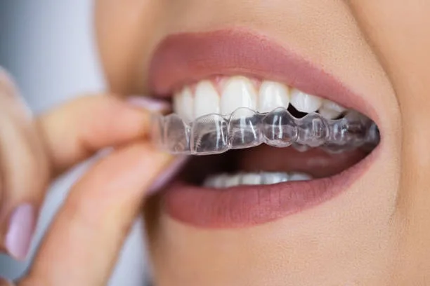 Agave Dental Care West - Implant Dentist — photo 3
