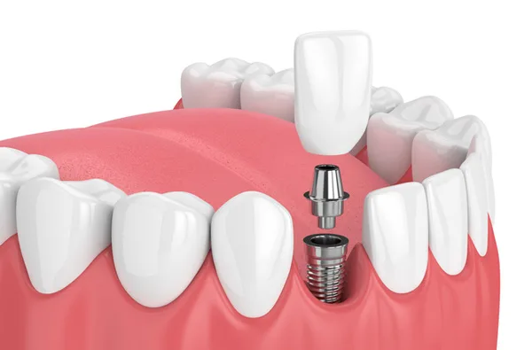 Alamo Family & Cosmetic Dentistry — photo 2
