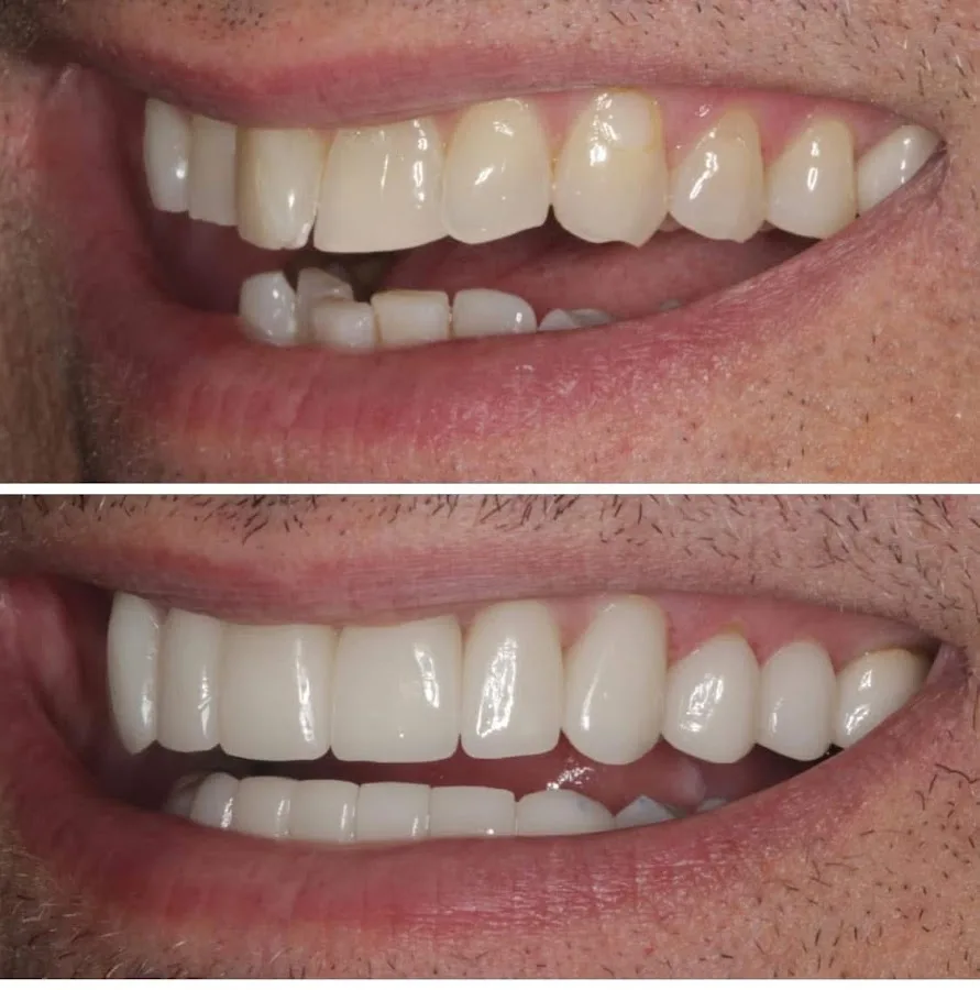 All New Smiles • Joshua B. Bernstein, DDS • Cosmetic Dentist Oakland • Sedation Dentistry • Invisalign Clear Braces — photo 1
