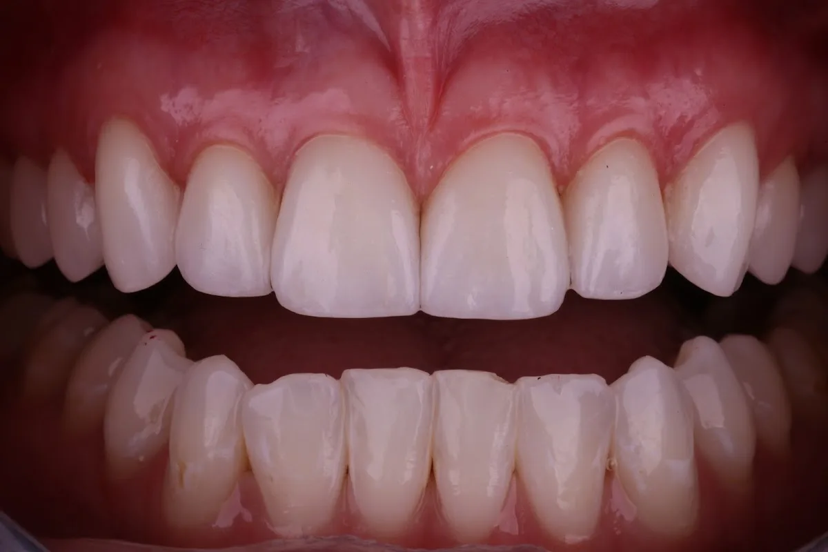 Angel Dental Care — photo 5