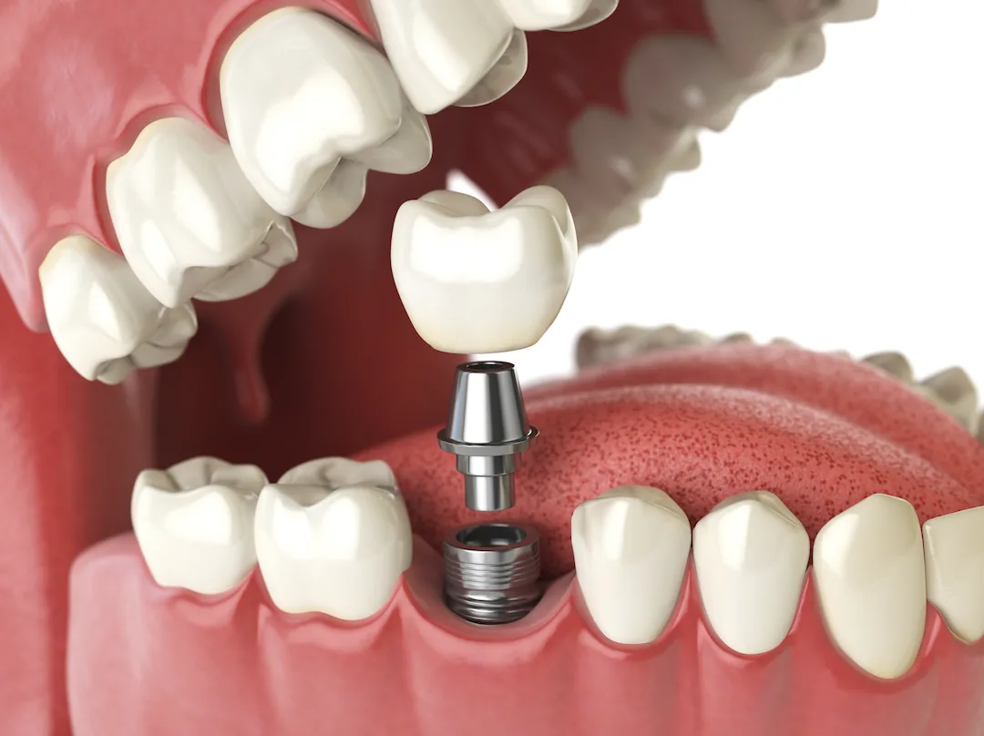 Boston Dental — photo 4