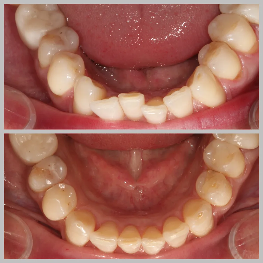 Bright Smile Dental of Brooklyn — photo 3