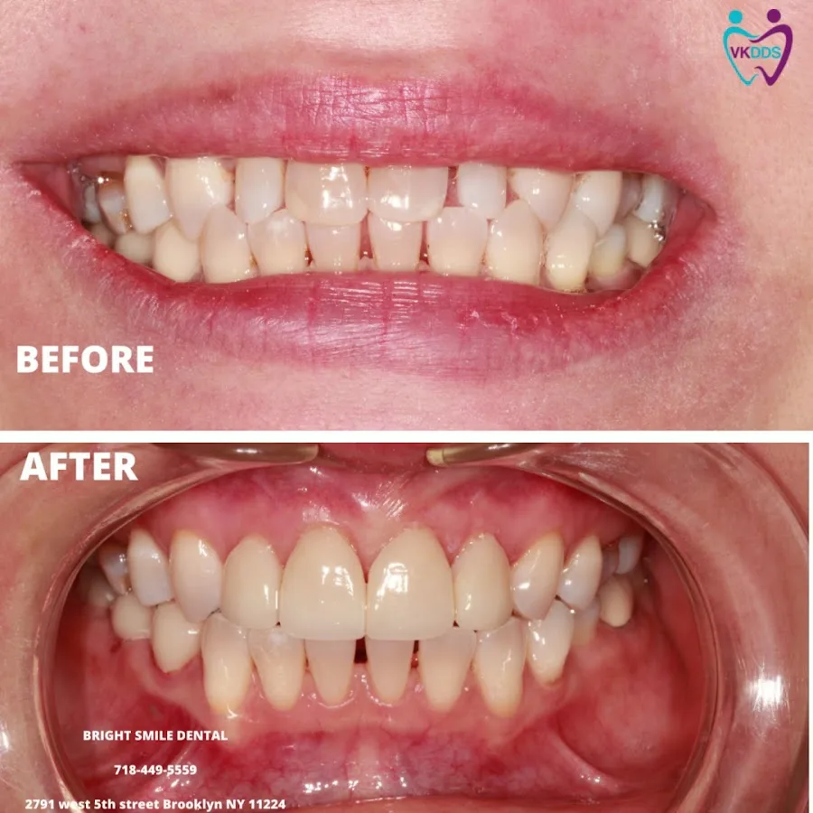 Bright Smile Dental of Brooklyn — photo 5