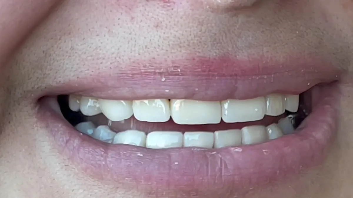 Buffalo General Dentistry | Implant, Sedation & Cosmetic — photo 5