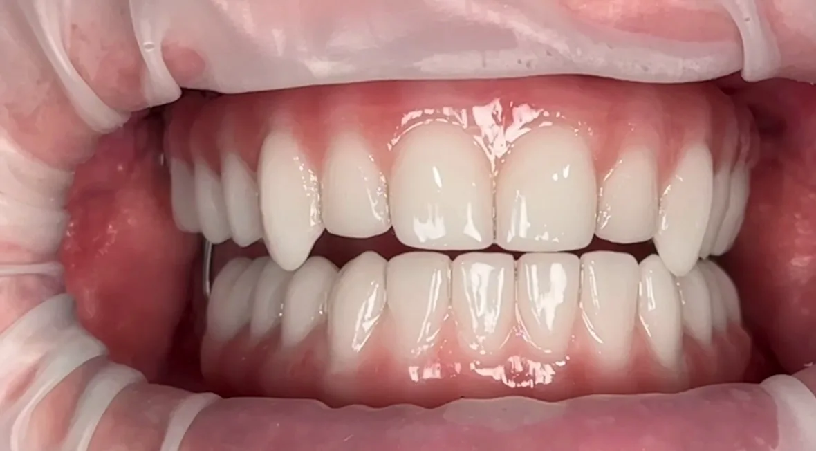 Bullard Dental