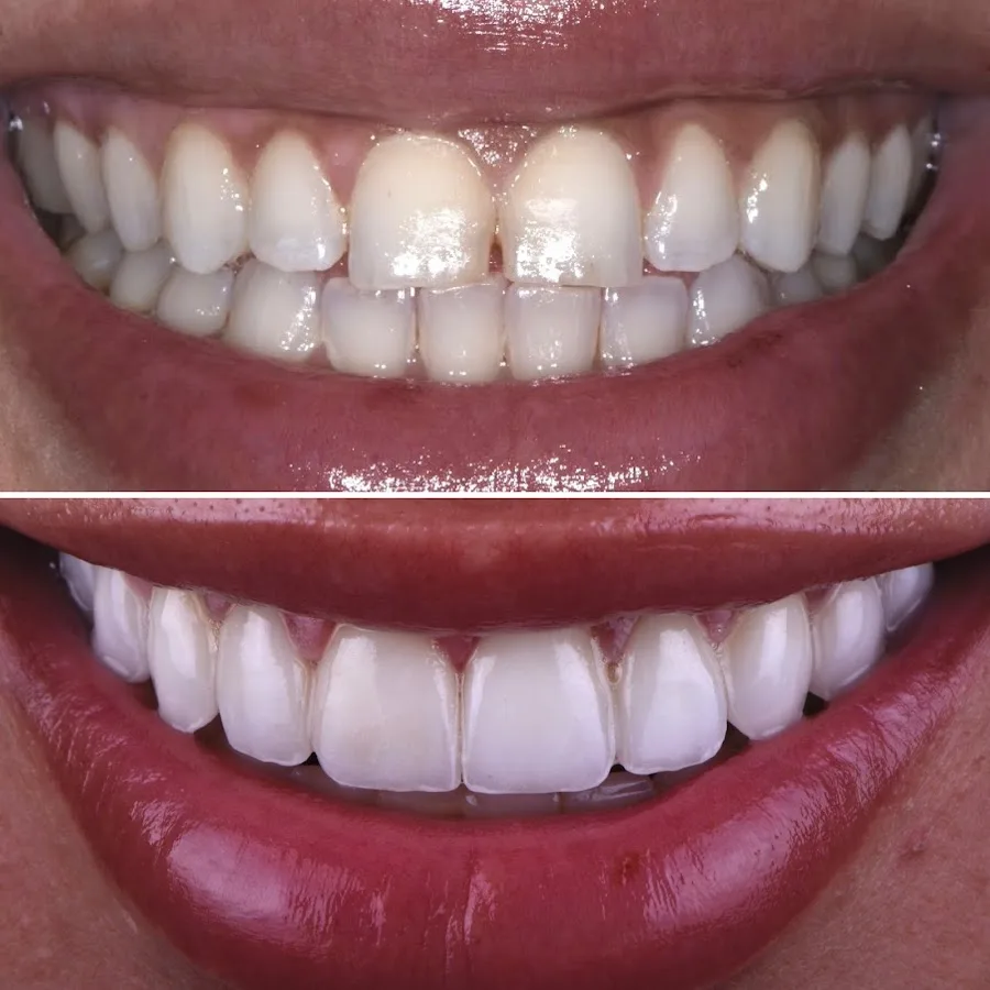 Center for Cosmetic and Family Dentistry — photo 5