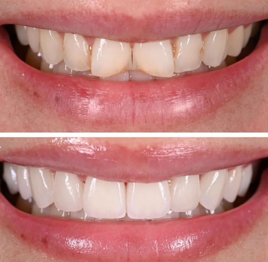 Cherry Hill Dentistry — photo 5