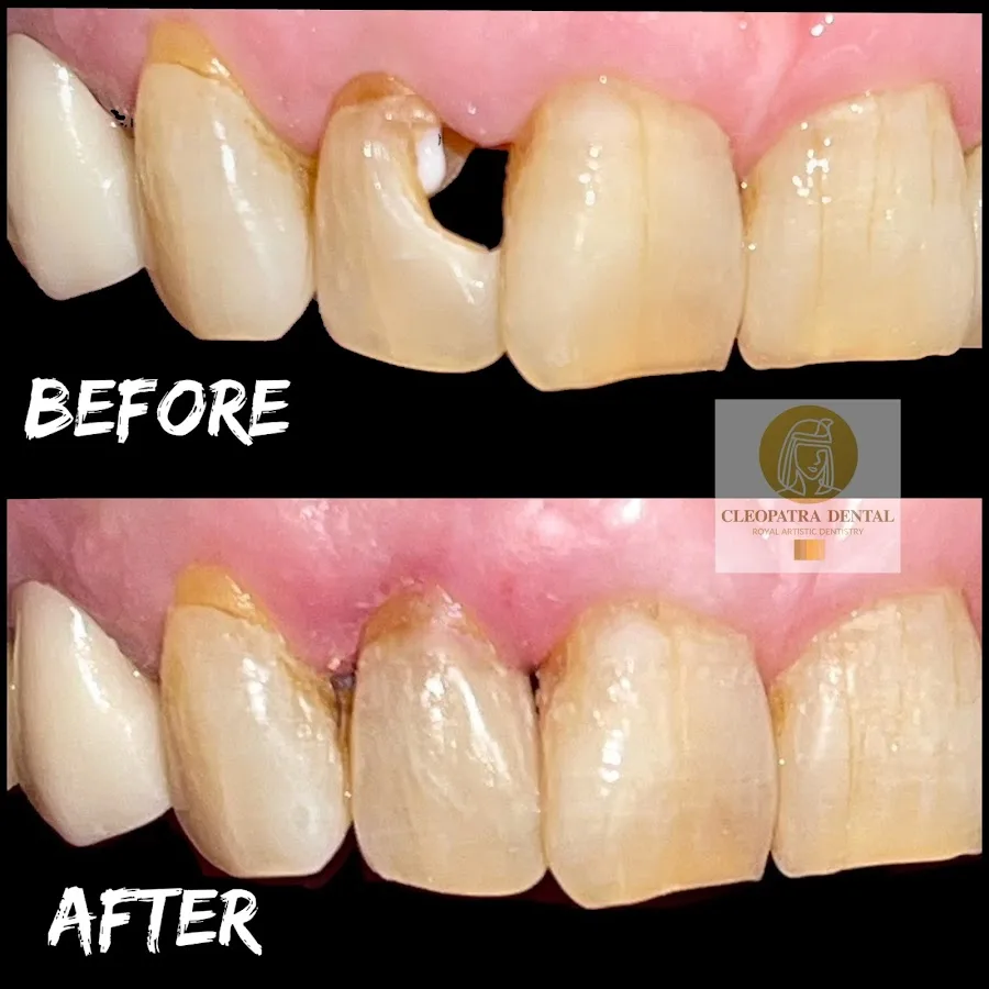 Cleopatra Dental | Riverside Dentist — photo 1