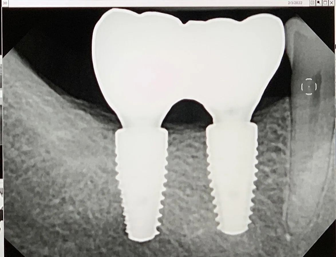 Contemporary Periodontics & Dental Implants