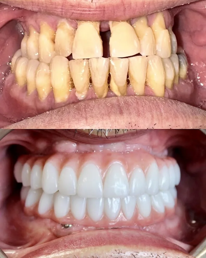 Cosmetic and Implant Dentistry of CT-Aaron M Gross DMD — photo 3