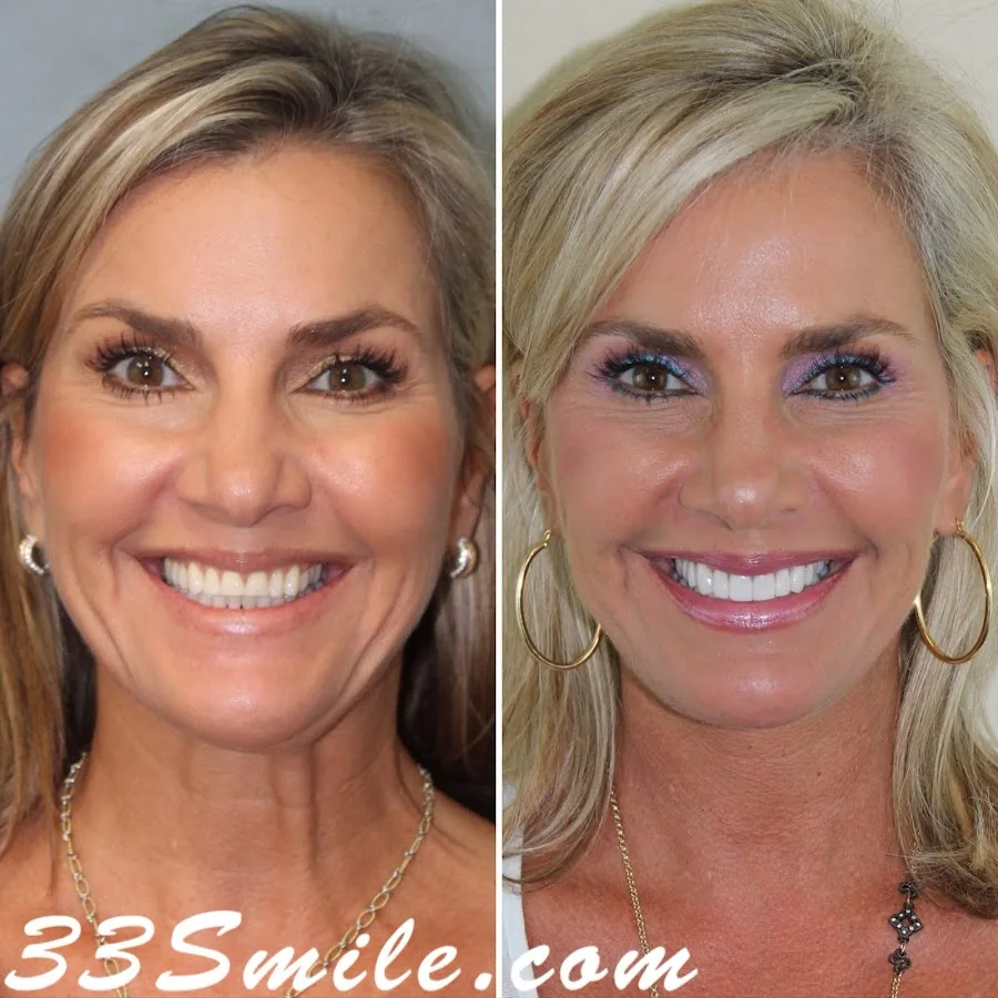 Cosmetic Dental Associates - Medical Center — photo 1