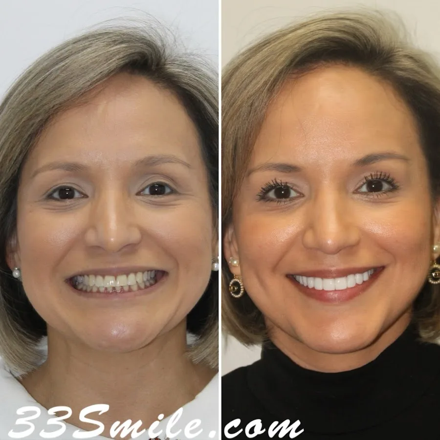 Cosmetic Dental Associates - Stone Oak — photo 1