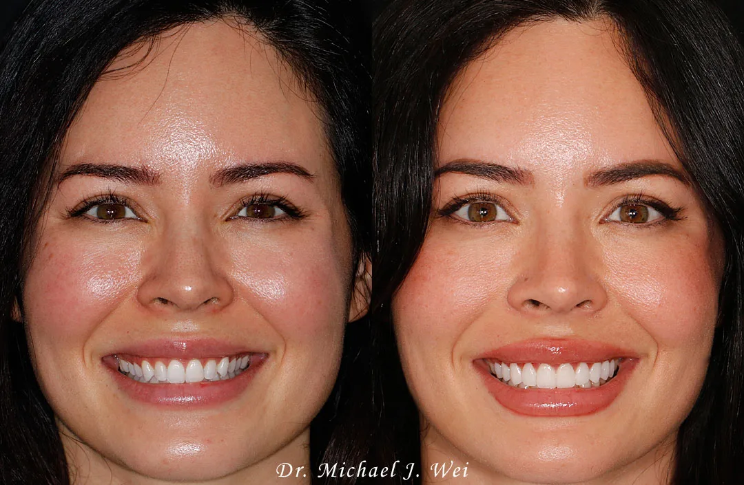 Cosmetic Dentistry Center NYC - Dr. Pia Lieb — photo 5
