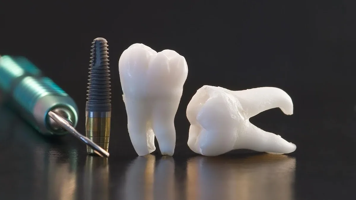 Creative Dental of Queens’ Dental Implants: How Patients in Rego Park Evaluate Candidacy and Plan the Timeline
