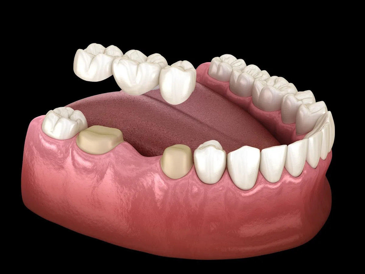 Crescent Family and Cosmetic Dentistry of Columbia — photo 1