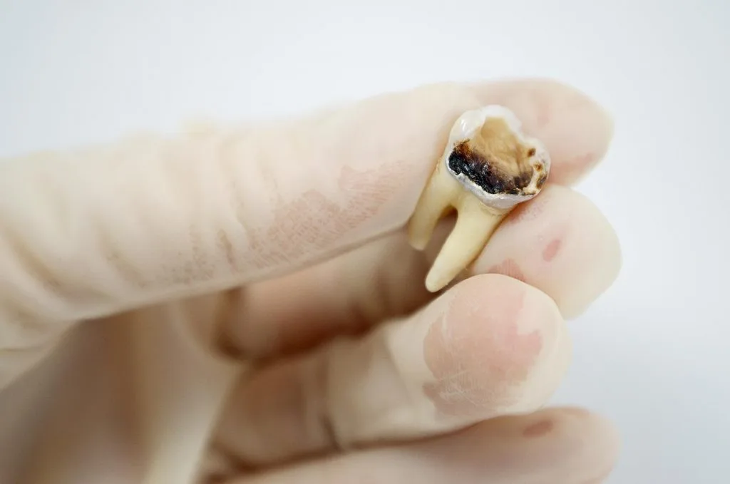 Crescent Family and Cosmetic Dentistry of Columbia — photo 2