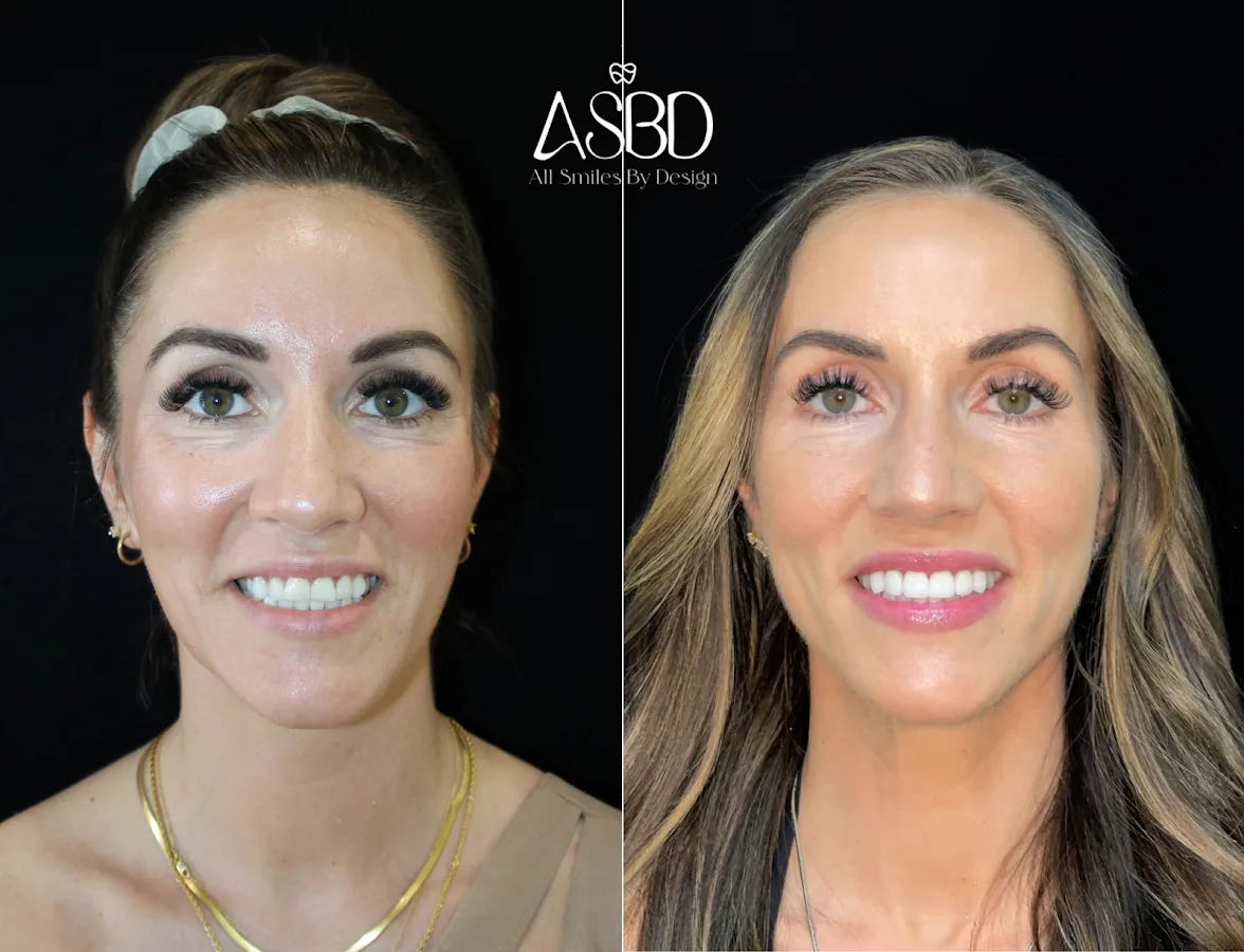 Dentist Henderson - All Smiles By Design — photo 1