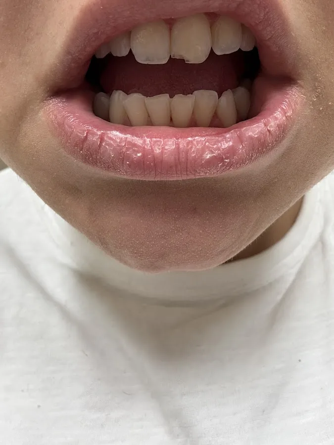 Dentist Riverside CA - Dental Specialists of Riverside - Emergency & Cosmetic Dentist — photo 2