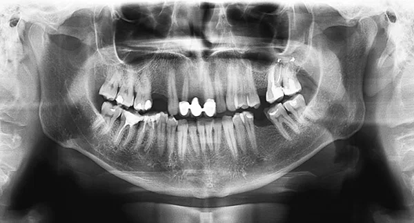 Dove Family Dentistry - Covington Pike — photo 2