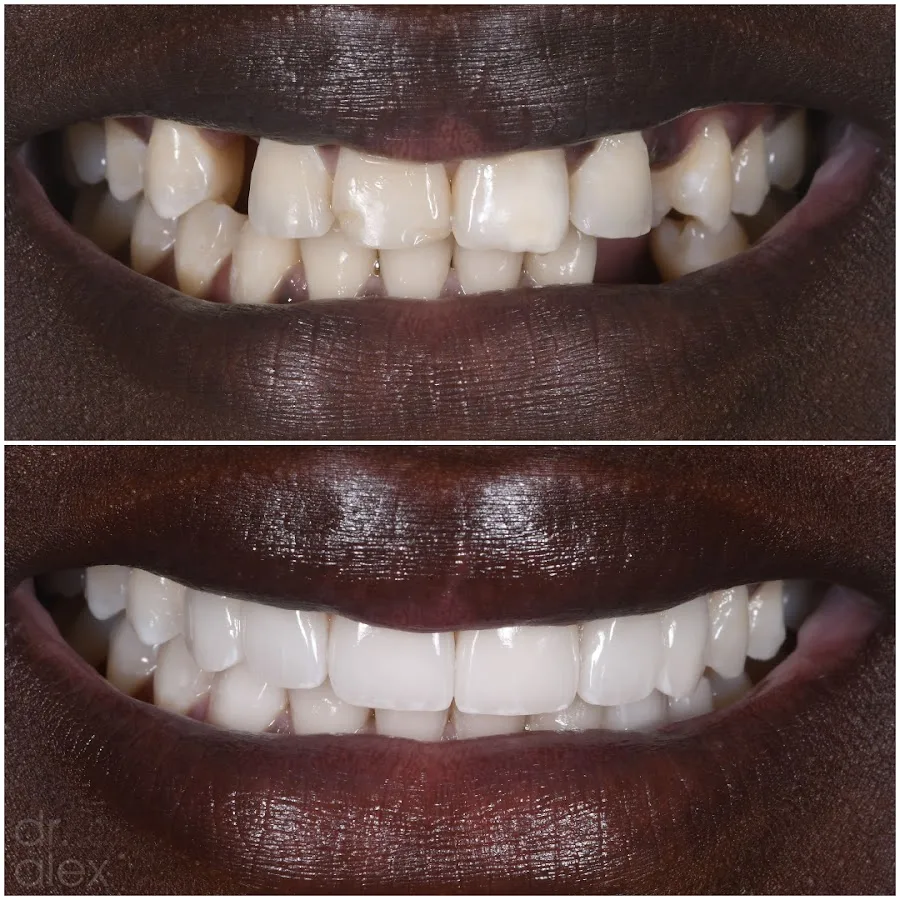 Dr. Alex Rubinov - NYC Cosmetic Dentist — photo 3