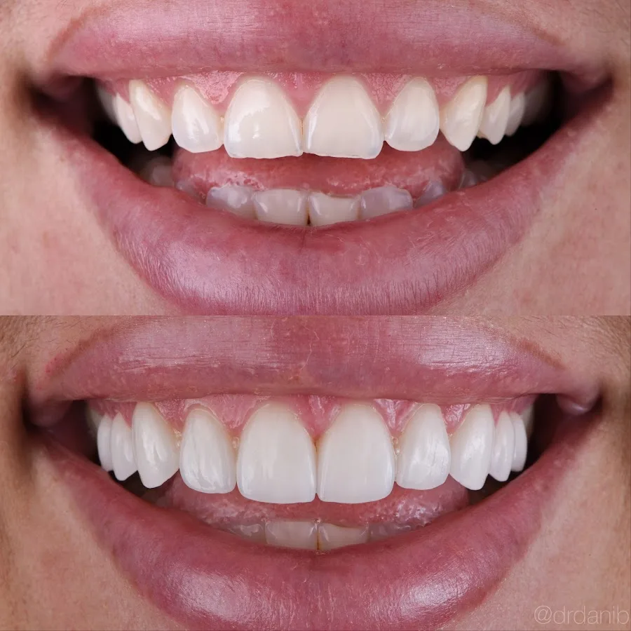 Dr. Dani Benyaminy, DDS — photo 1