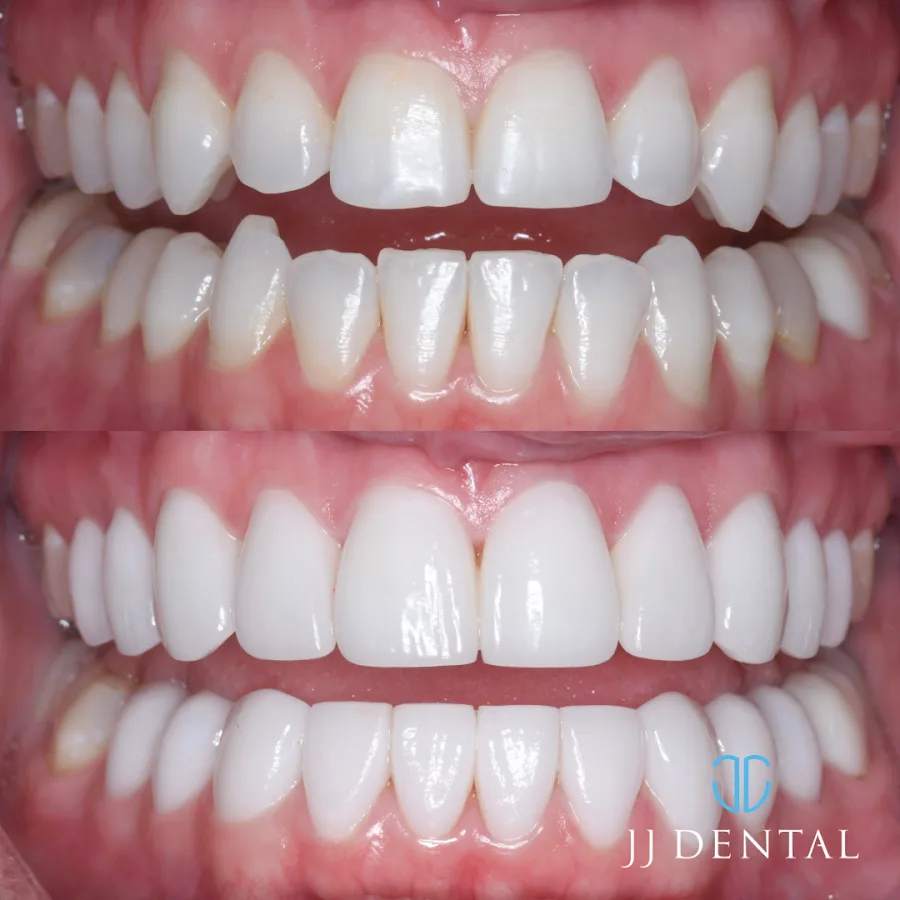 Dream Smile Center: Dr. Jeff Bartlett & Dr. Isabel Castillo — photo 4