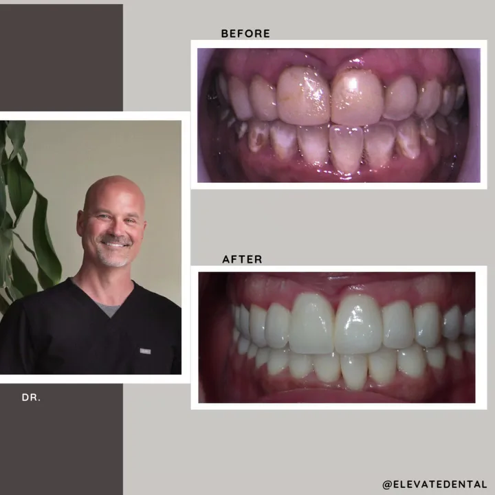 Elevate Dental - Dayton — photo 3