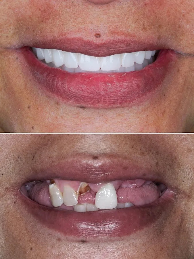 Eleve Dental Cosmetic & Implant Center — photo 1
