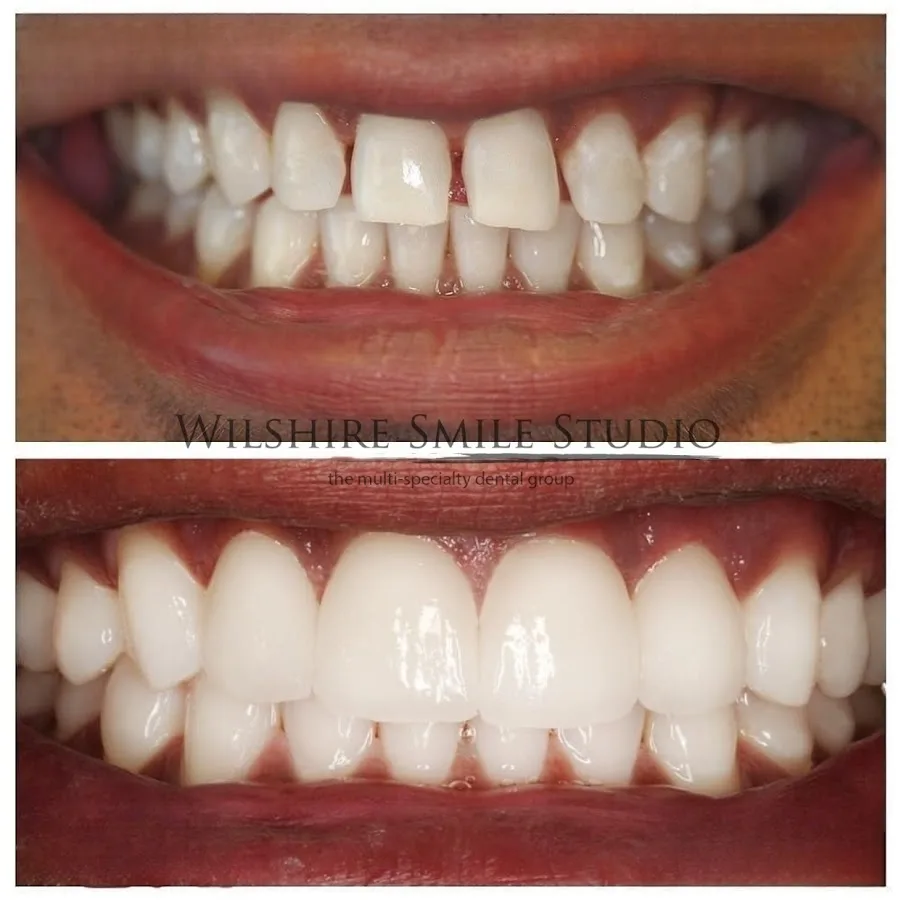 Exquisite Dentistry — photo 4