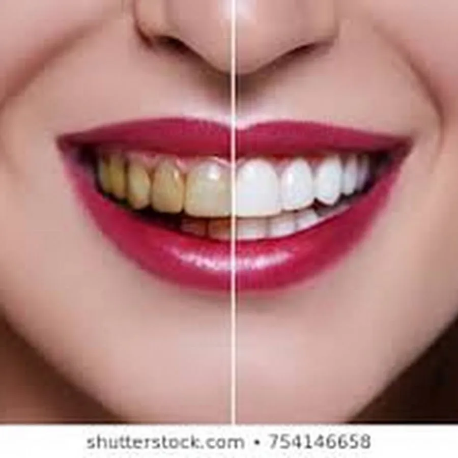 Family And Cosmetic Dentistry — photo 3