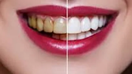 Family And Cosmetic Dentistry (Albany, NY) Consultation Fit: What to Confirm Before You Book