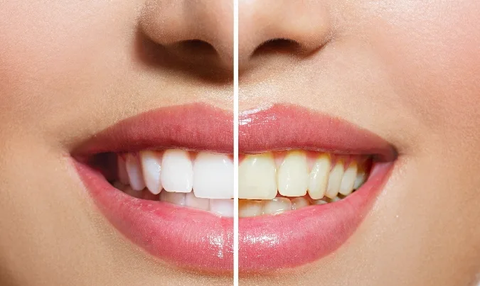 Ferro Family Cosmetic Dentistry — photo 3