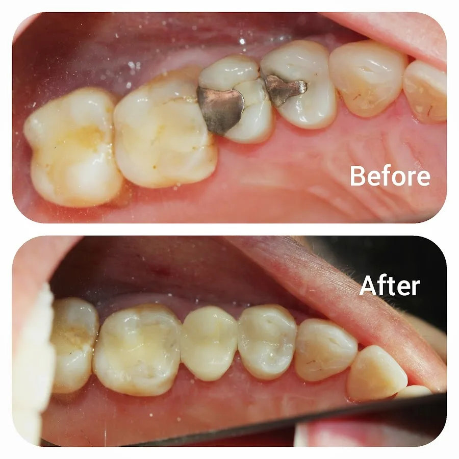 Galvez Dental