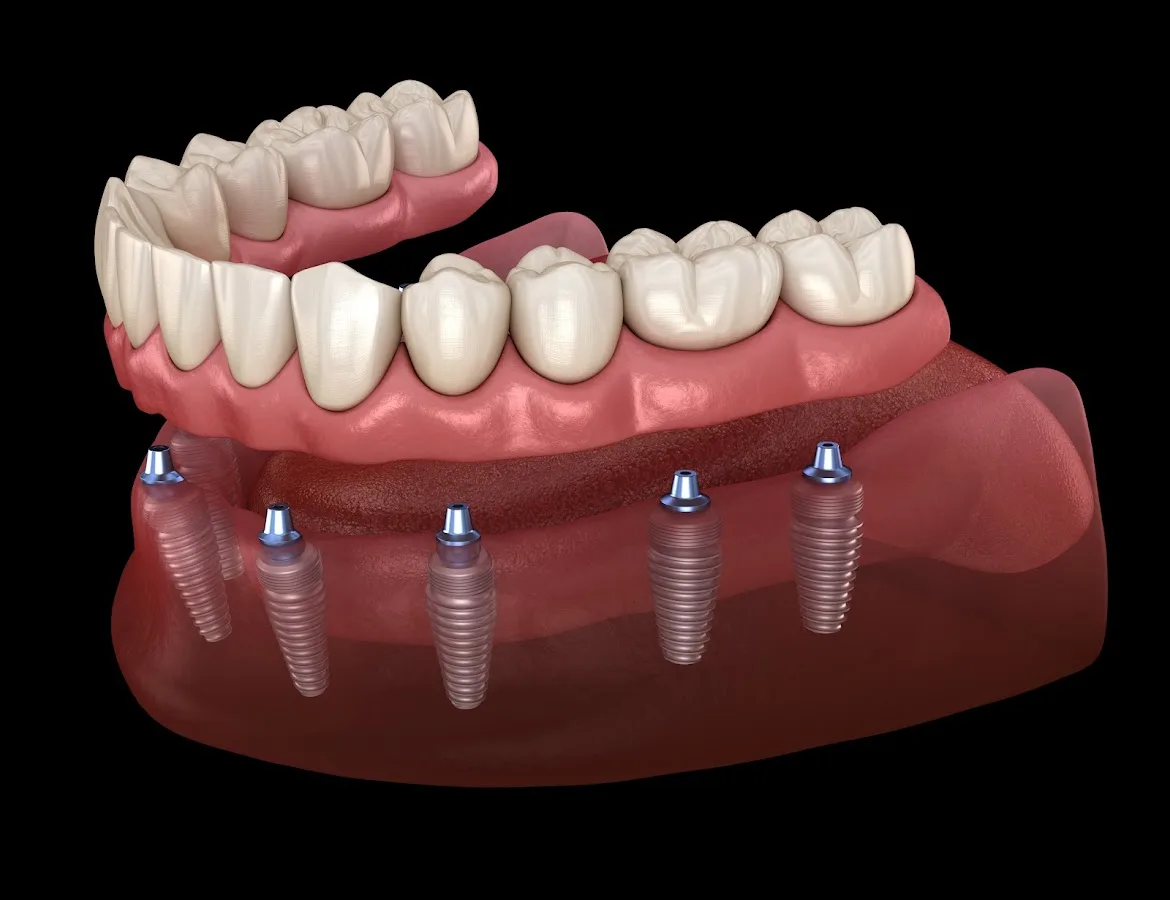 Gordon Dental Implants and Cosmetics — photo 1
