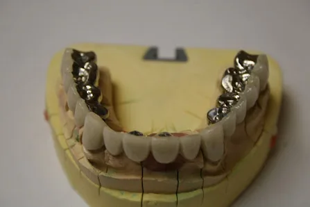 Hollywood Smile — photo 4