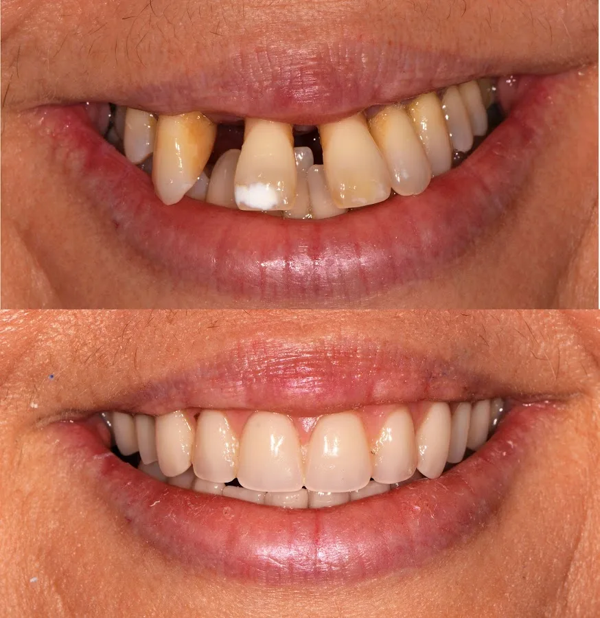 Honolulu Smile Design — photo 1