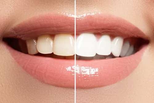 James River Family Dentistry — photo 3
