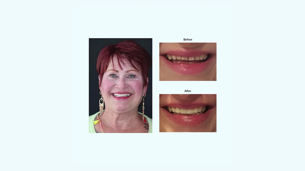 Mesa Dental — photo 5