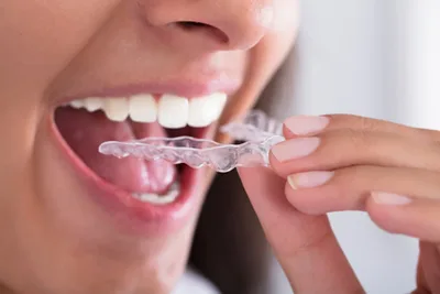 Montclair Smile Design — photo 4