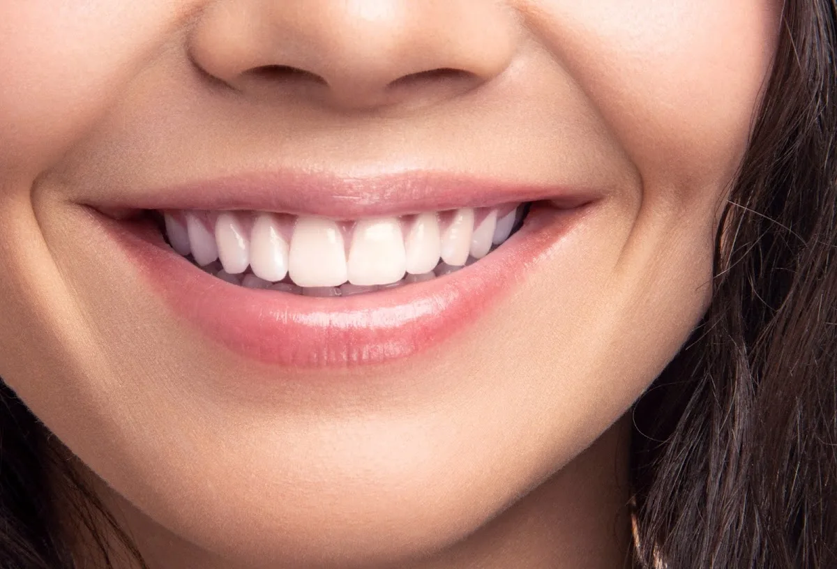 North Shore Cosmetic and Implant Dentistry — photo 5