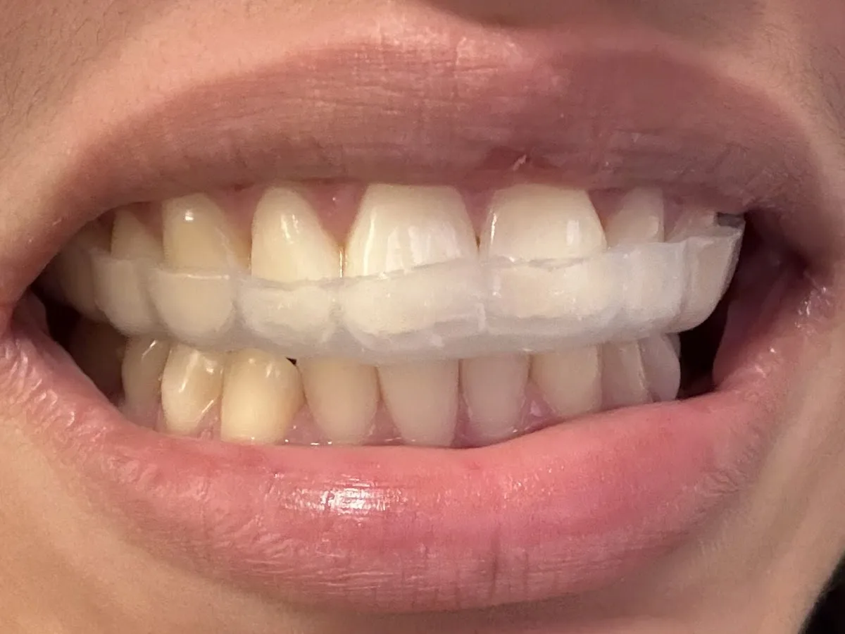 Park Slope Dental Arts — photo 5