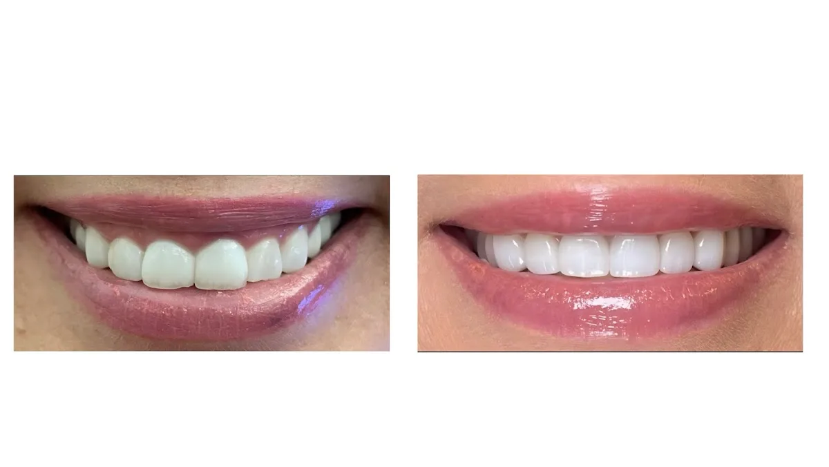 Peachtree Smile Center — photo 4
