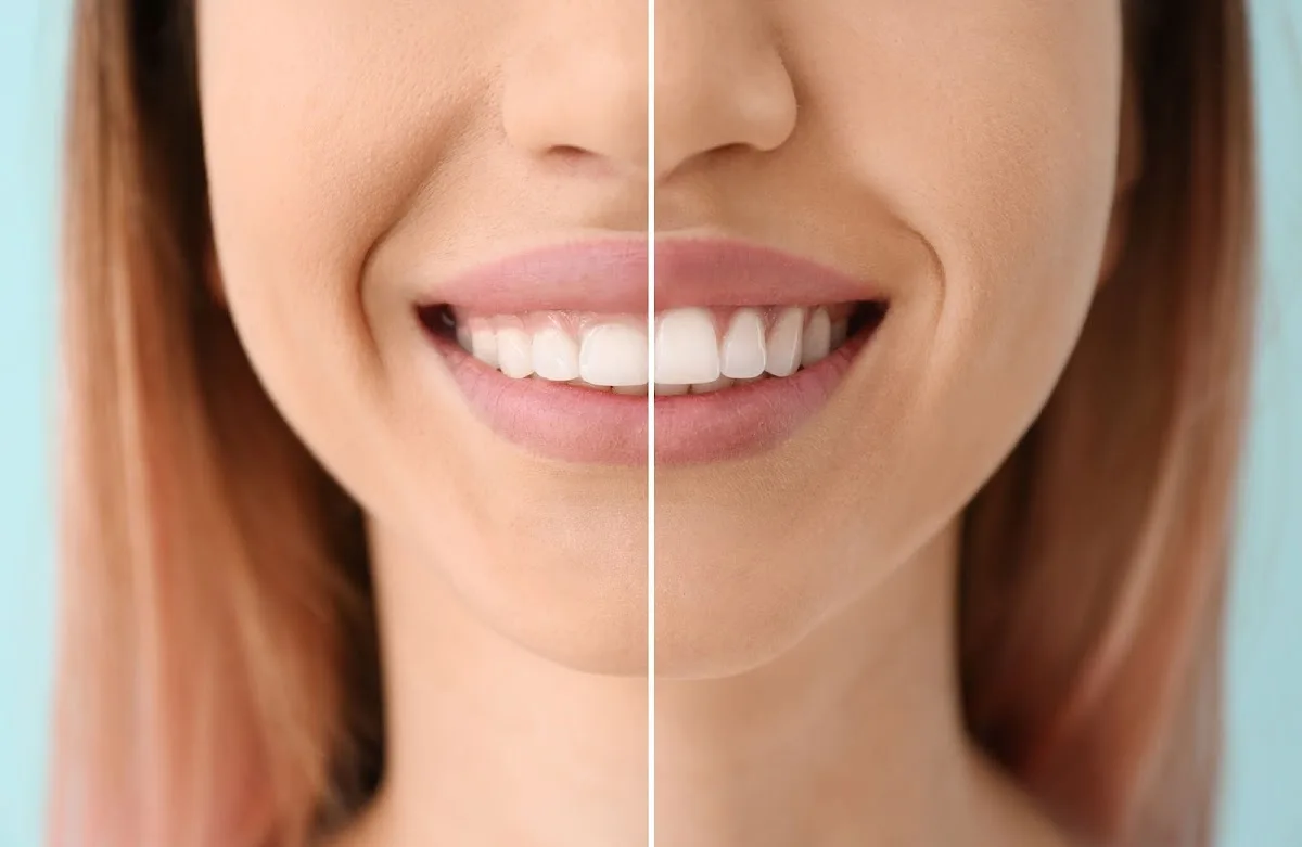 Pinnacle Dentistry — photo 3
