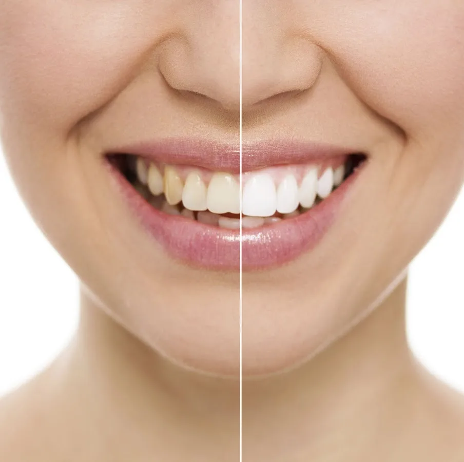 Precious Smiles Cosmetic Dentistry — photo 1
