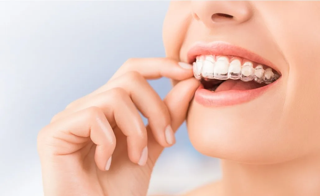 Smile Brite Dental — photo 3