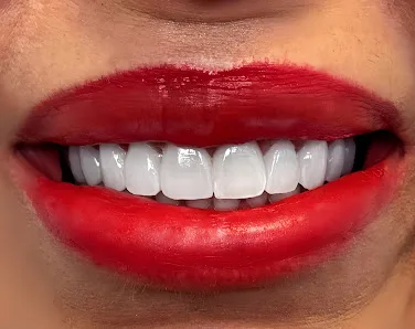 Smile Design Manhattan — photo 4