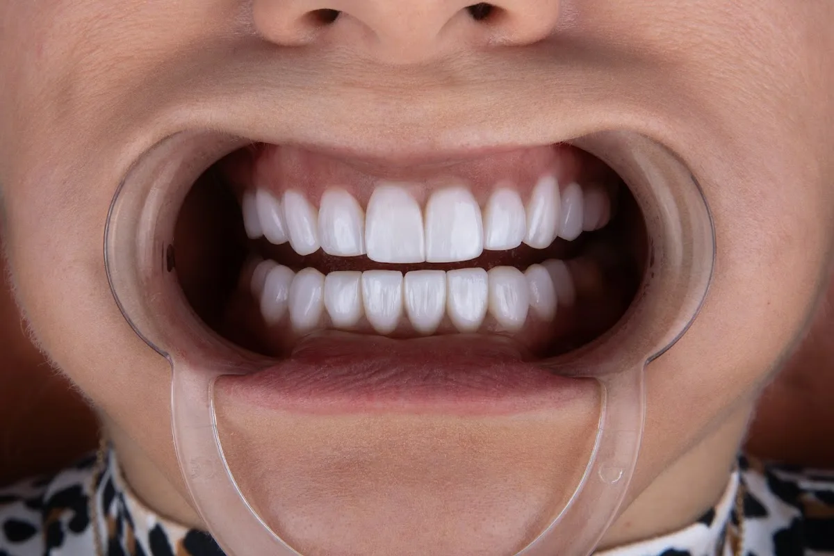 Smile Design Miami — photo 1