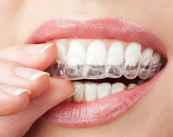Smile Studio Dentistry — photo 3
